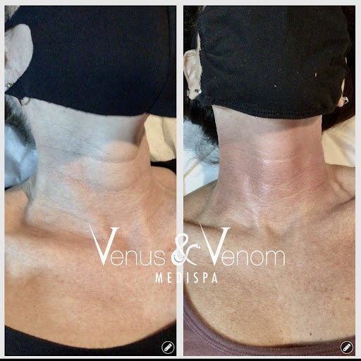 Venus & Venom MEDIspa Monroe - Thumbnail