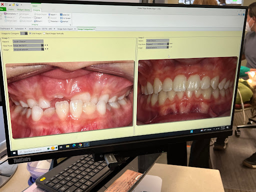 Dr. Lints Orthodontics - Traverse City Gallery - United States