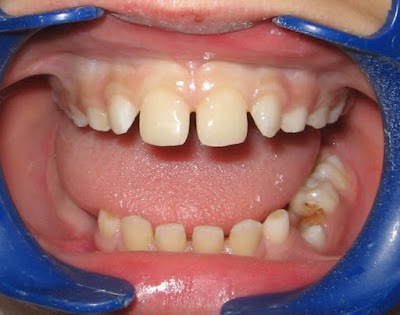Photos of Dr. Taner Akca