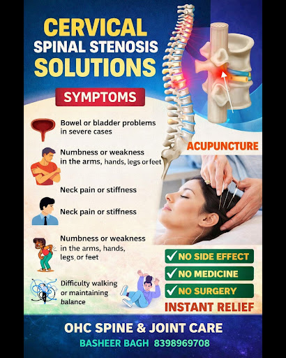 🌿 Cervical Spinal Stenosis — Find Relief Without Surgery! post image