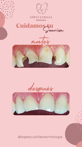 López Cubilla Odontología