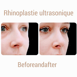 Photo n°13 de Dr Franck Ouakil, chirurgien esthétique à Paris à Paris (Clinique de chirurgie plastique)