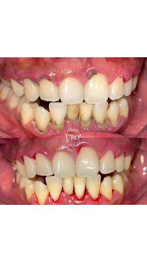 Consultorio Dental “Pro” Dra. Yoselin Bandala - Thumbnail