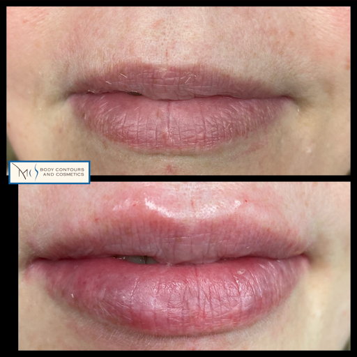 MI Body Contours and Cosmetics MedSpa