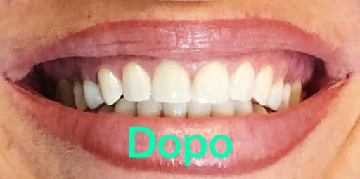 Studio Odontoiatrico Lattarulo - Thumbnail