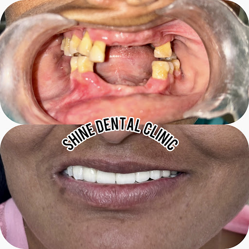 Dental care  post image