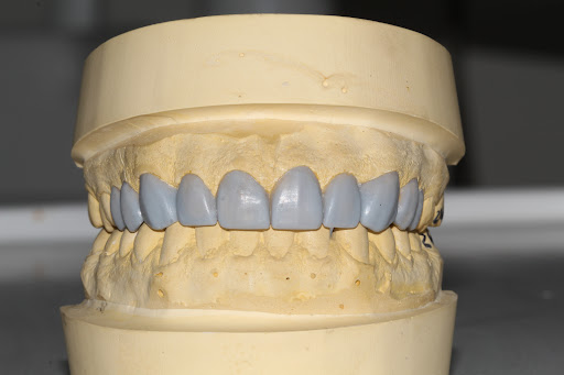 Dentista Buco dent - Thumbnail