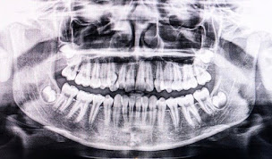 Photo n°2 de Centre de radiologie et scanner Henry Dunant IMAGERIE PARIS 16 à Paris (Radiologue)