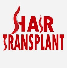 Hair Transplant in Pakistan islamabad