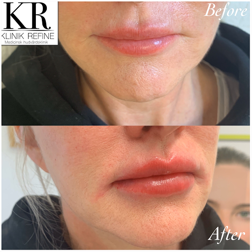 Klinik Refine - Thumbnail