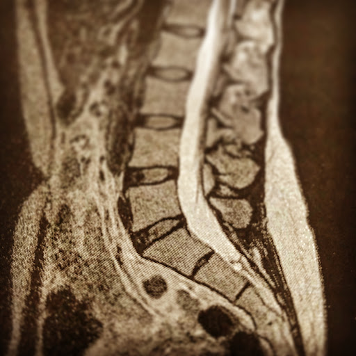 Fisioterapia MAR - Thumbnail