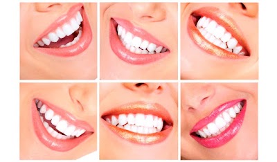 Photos of Denti Vitale Dentistas Guatemala