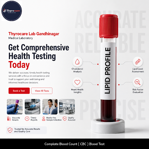 Thyrocare Gandhinagar offers comprehensive medical testing including Lipid Profile, Allergy Tests…