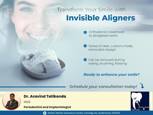 Know About Invisible Aligners post image