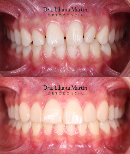 Dra Liliana Martín - Ortodoncia y Odontología general - Thumbnail
