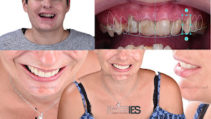 Photo n°11 de Cabinet Dentaire IES à Ambérieu-en-Bugey (Dentiste)