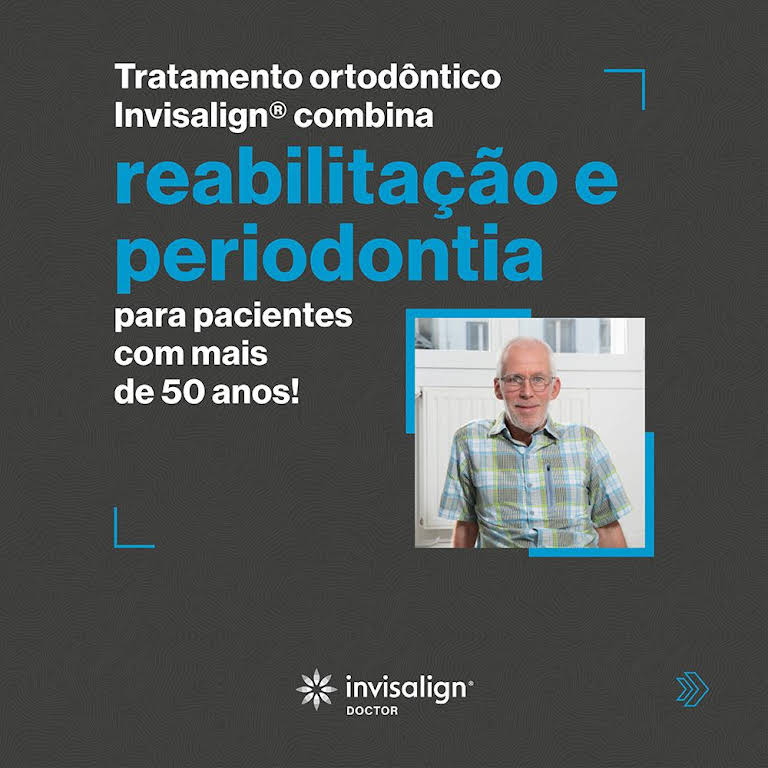 Arcadas amplas para um sorriso perfeito - Invisalign BH - Clínica Rodrigo  Almada