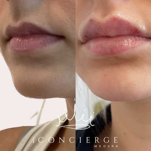 IConcierge Medspa