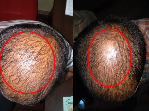 DON'T WORRY GET TREATED AT YASHAAYU MULTISPECIALITY AND PANCHAKARMA CENTRE 