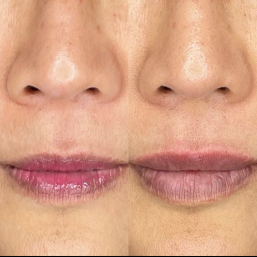 SkinVana Medspa