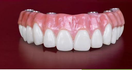 A PLUS DENTURES - Visual