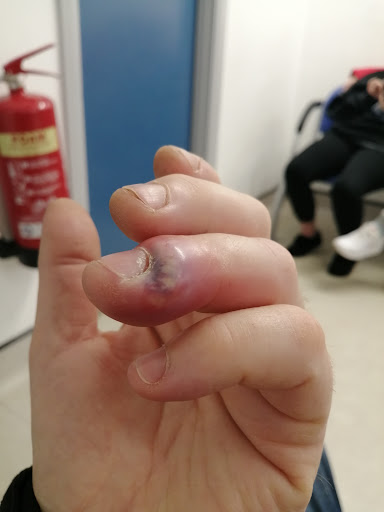 Erith Hospital Urgent Care Centre - Thumbnail