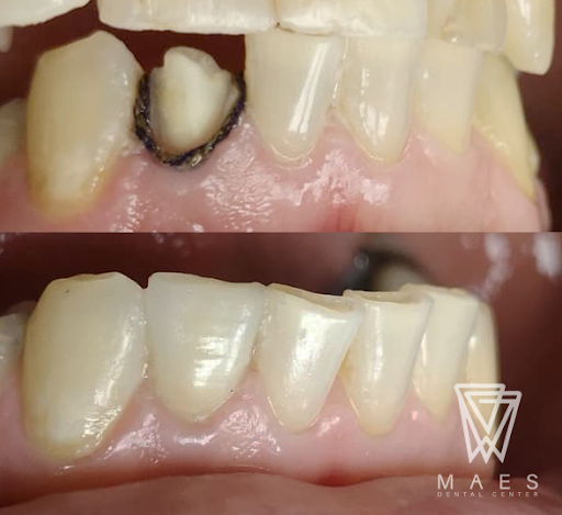 MAES Dental Center - Thumbnail