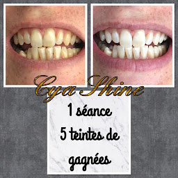 Photo n°9 de Cya Shine à Saint-Pierre-Brouck (Institut de beauté)