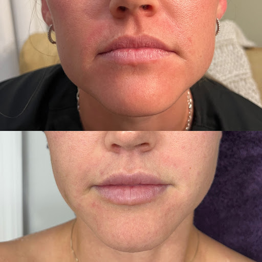 RAYNĒ MEDSPA | AESTHETICS