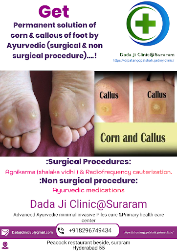 We provide also treatment of corn &callous of foot...Get 100% result from such issues. post image