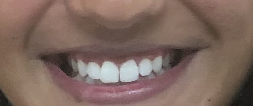 The Whitening Clinic - Thumbnail