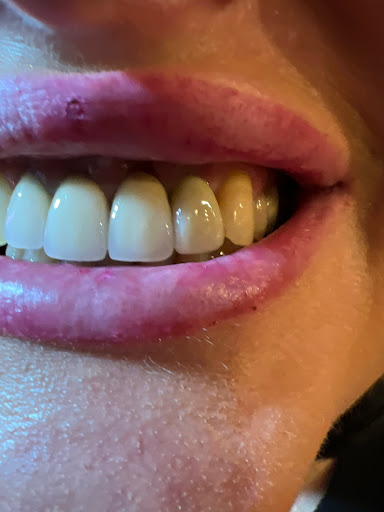 Features Nottingham - Dentistry & Facial Aesthetics - Thumbnail