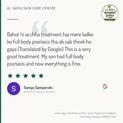 Saniya Saniyaruks loved the exceptional care at AL Shifa Skin Care Centre, a renowned doctor in H… post image