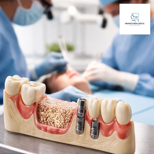 Thinking about dental implants but worried your jawbone may be too weak? At Advanced Maxillofacia… post image
