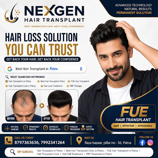 Hair transplant patna post image
