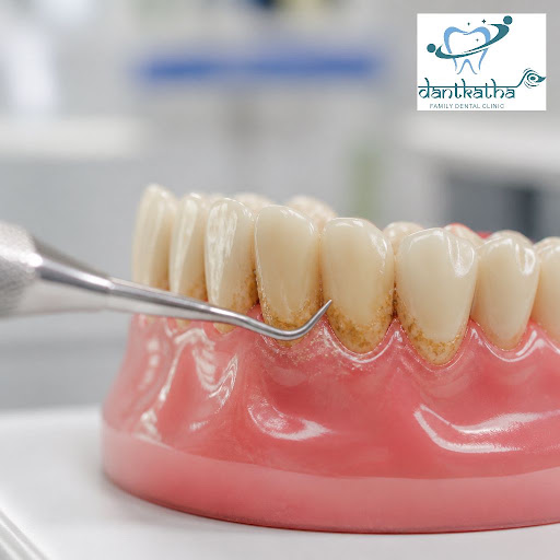 Healthy gums are the foundation of a confident smile. At Dantkatha Family Dental Clinic, we focus… post image