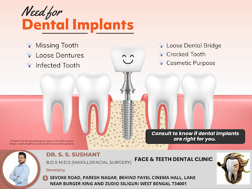 Patients choose dental implants to replace one or more missing teeth. They address functional iss… post image