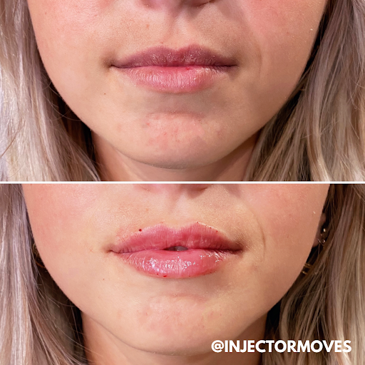 GLOW Aesthetic Clinic