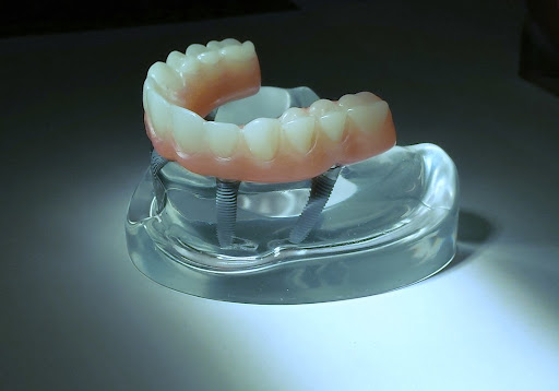 Denturologie Ste-julie - Thumbnail