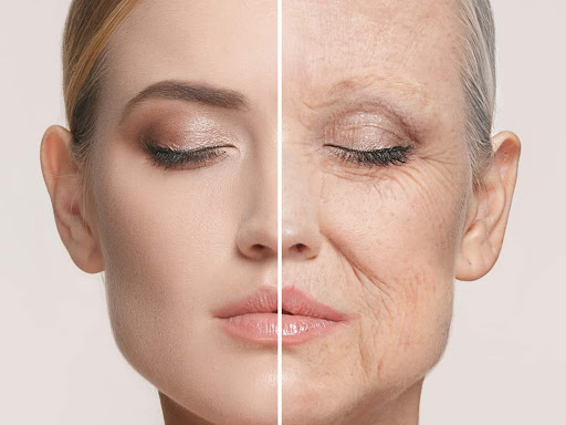 HIFU treatment  post image