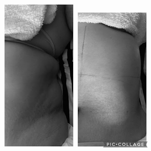 My Plump Derrière spa