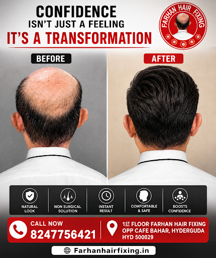 **Farhan Hair Fixing – Hyderabad** post image