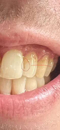High Brooms Dental Clinic Gallery - United Kingdom