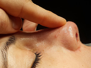 Photo n°3 de Docteur Grégory Wycisk - Rhinoplastie à Livry-Gargan (Chirurgien plasticien)