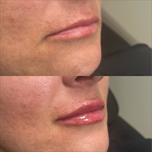 Smiley Aesthetics Medical Spa – Botox & Weight Loss Clinic Nashville West