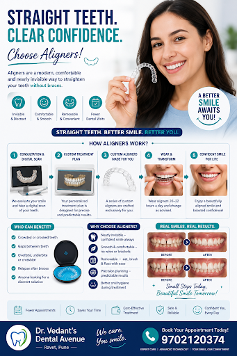 Aligners post image