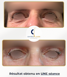 Photo n°19 de Centre Laser Villefranche - Centre Esthétique et Lasers Médicaux à Limas (Médecin)