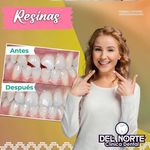 Clínica Dental Del Norte, San Cristóbal De Las Casas, Implantes Dentales - Thumbnail