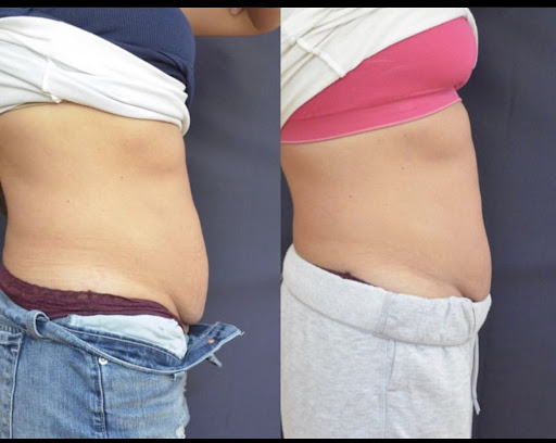 Clove Lakes Laser Center & Medical Spa - Thumbnail