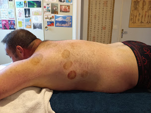 Photo n°6 de Massage chinois à Onet-le-Château (Kinésithérapeute)